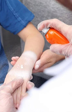 Детские ожоги: первая помощь и лучшие средства