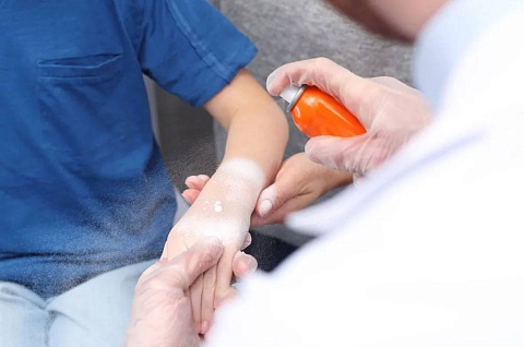 Детские ожоги: первая помощь и лучшие средства